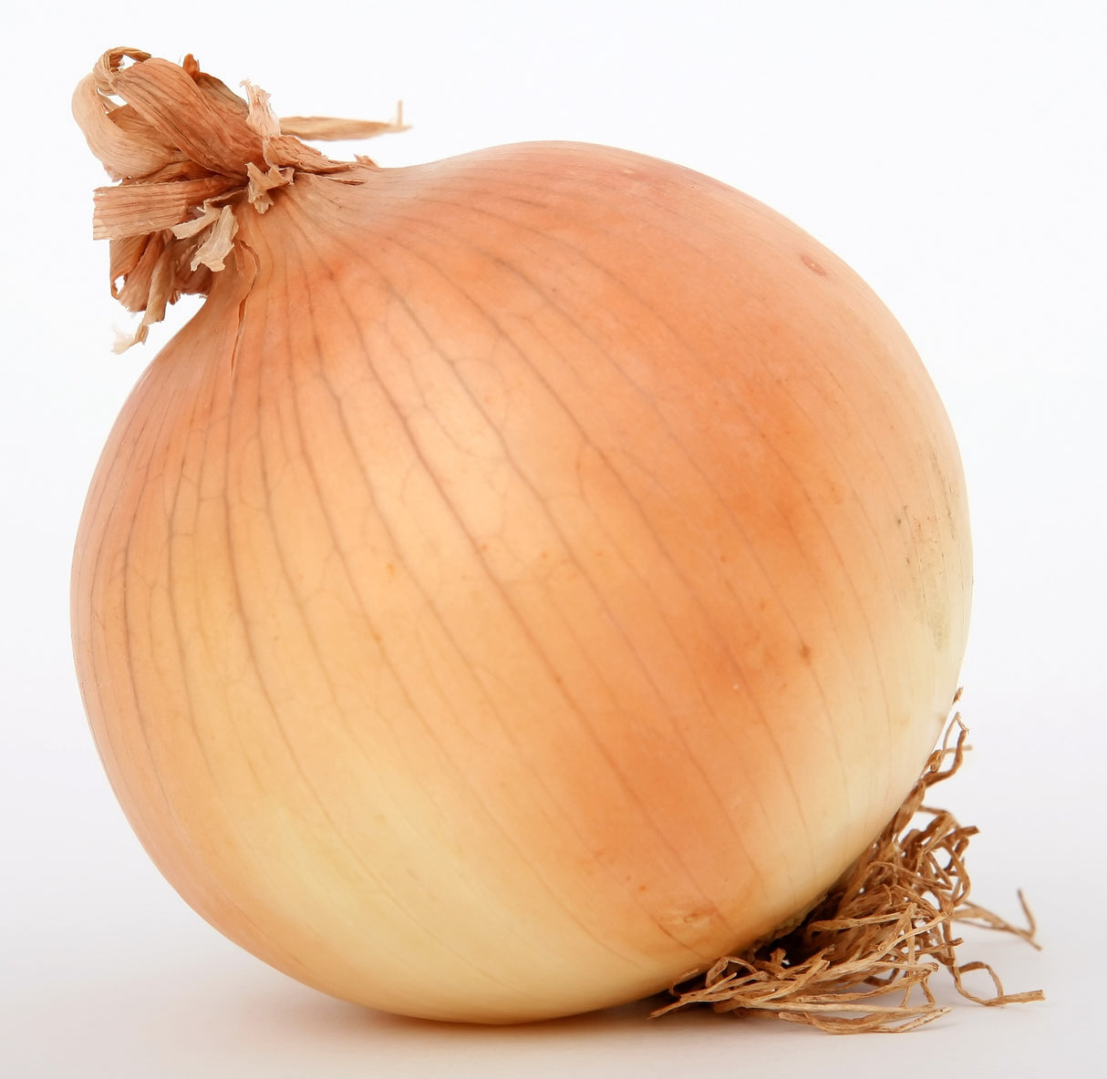 Cebolla (kg)